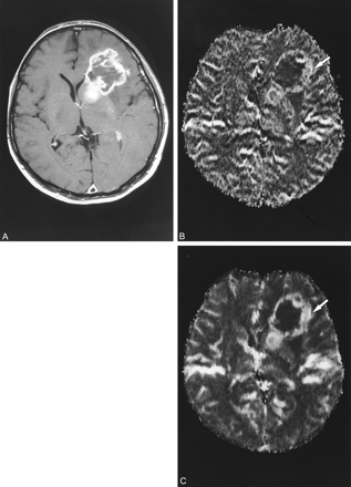 fig 3.