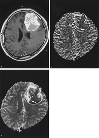 fig 4.