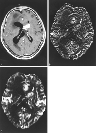 fig 6.