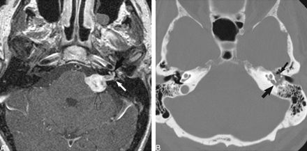 fig 7.