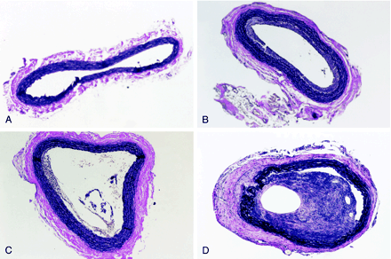 fig 2.