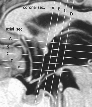 fig 1.