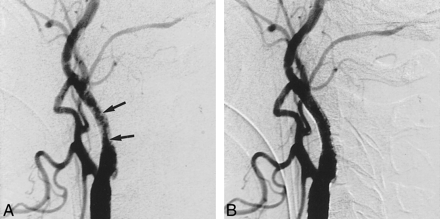 fig 4.
