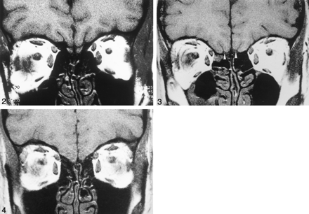 Fig 3.
