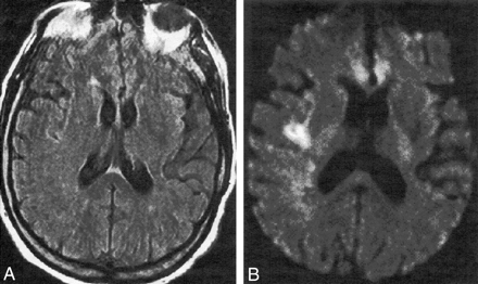 Fig 4.