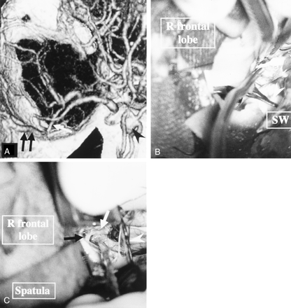 Fig 5.