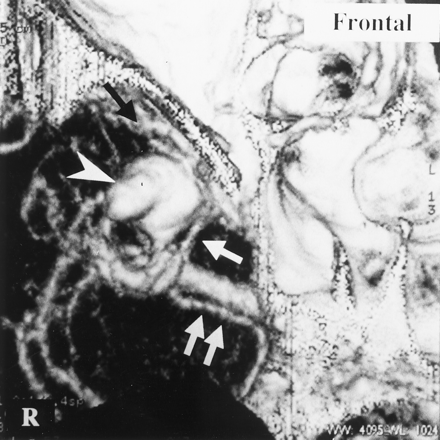 Fig 7.