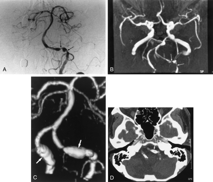 Fig 4.