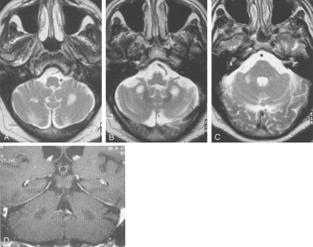 Fig 1.