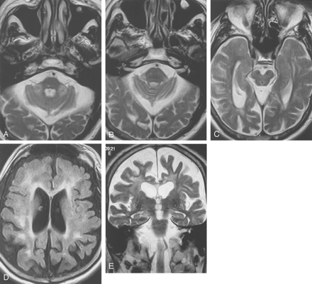 Fig 4.