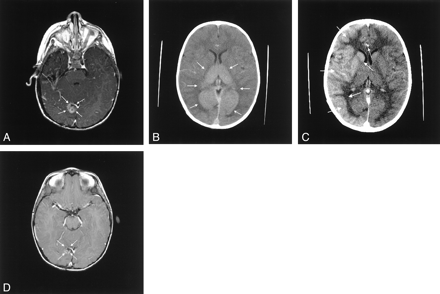 Fig 1.