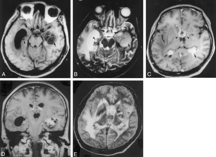 Fig 1.