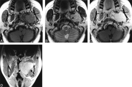 Fig 1.