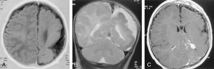 Fig 1.