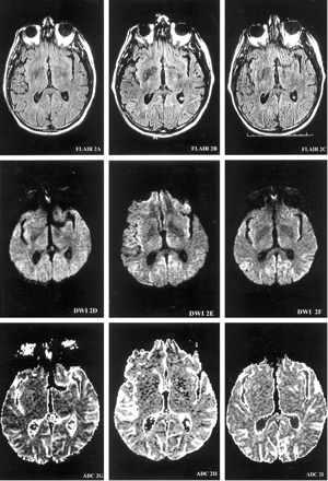 Fig 1.