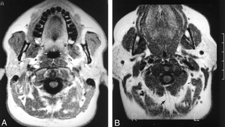 Fig 5.