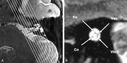 Fig 1.