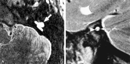 Fig 3.