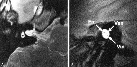 Fig 5.