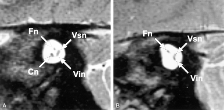 Fig 6.