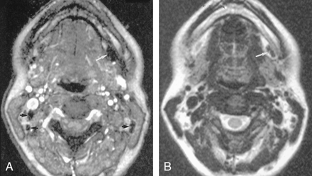 Fig 3.
