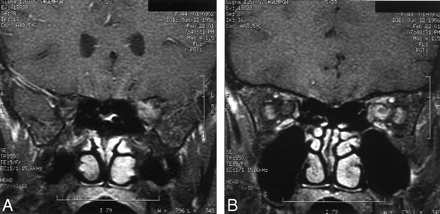 Fig 1.