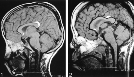 Fig 2.