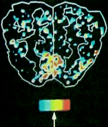 Fig 2.