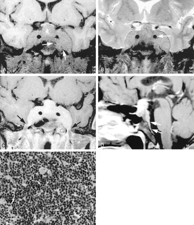 Fig 1.