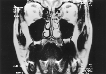 Fig 1.