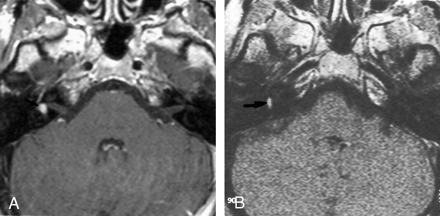 Fig 2.