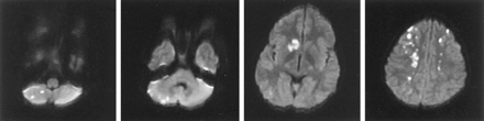 Fig 2.