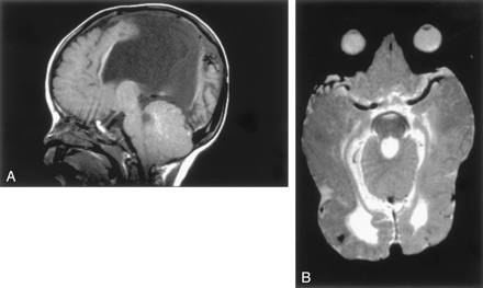 Fig 10.