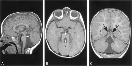 Fig 11.