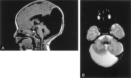 Fig 2.