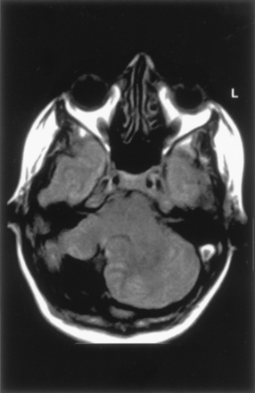 Fig 4.