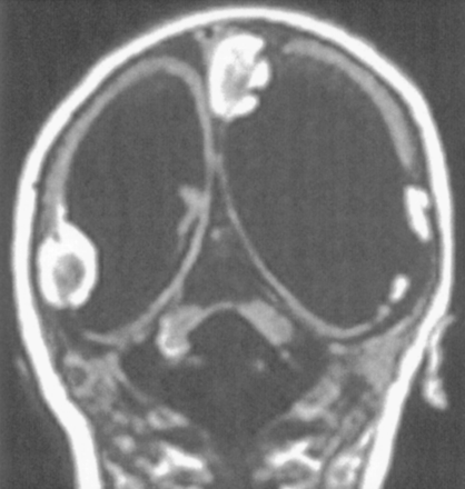 Fig 8.