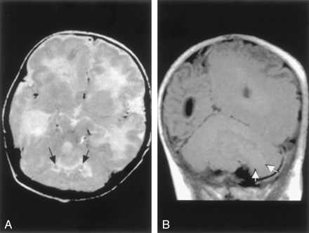 Fig 9.