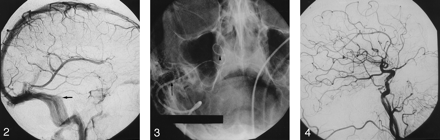 Fig 3.