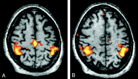 Fig 2.