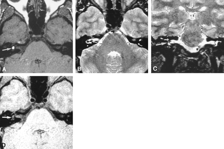 Fig 2.