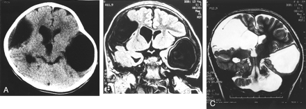 Fig 2.