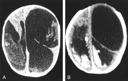 Fig 3.