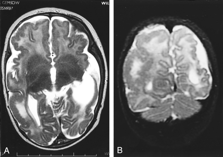 Fig 6.