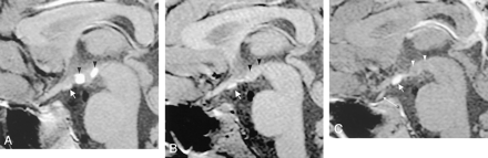 Fig 4.