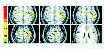Fig 2.