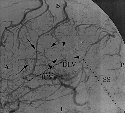 Fig 3.