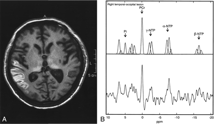 Fig 2.