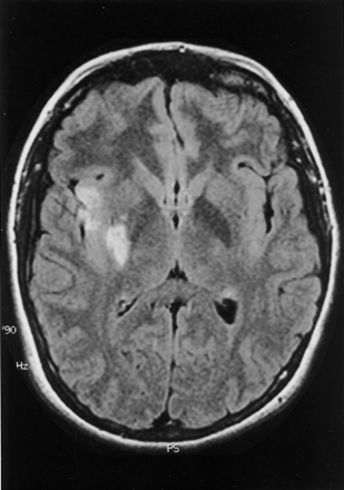Fig 2.