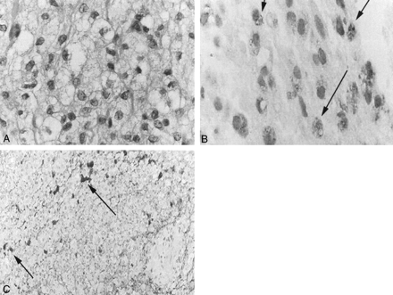 Fig 3.